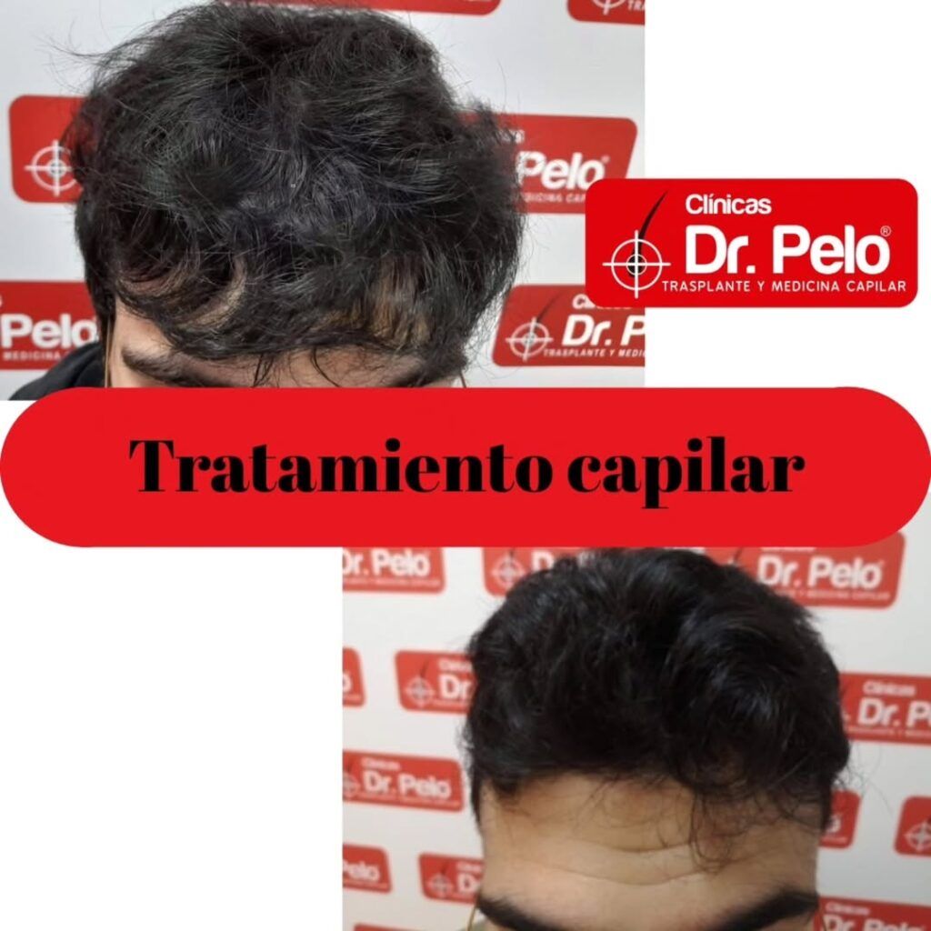 tratamiento-capilar-online-01