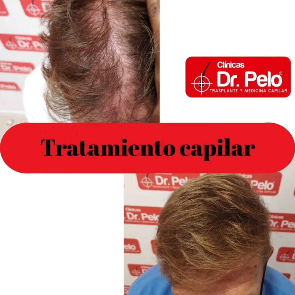 tratamiento-capilar-online-02