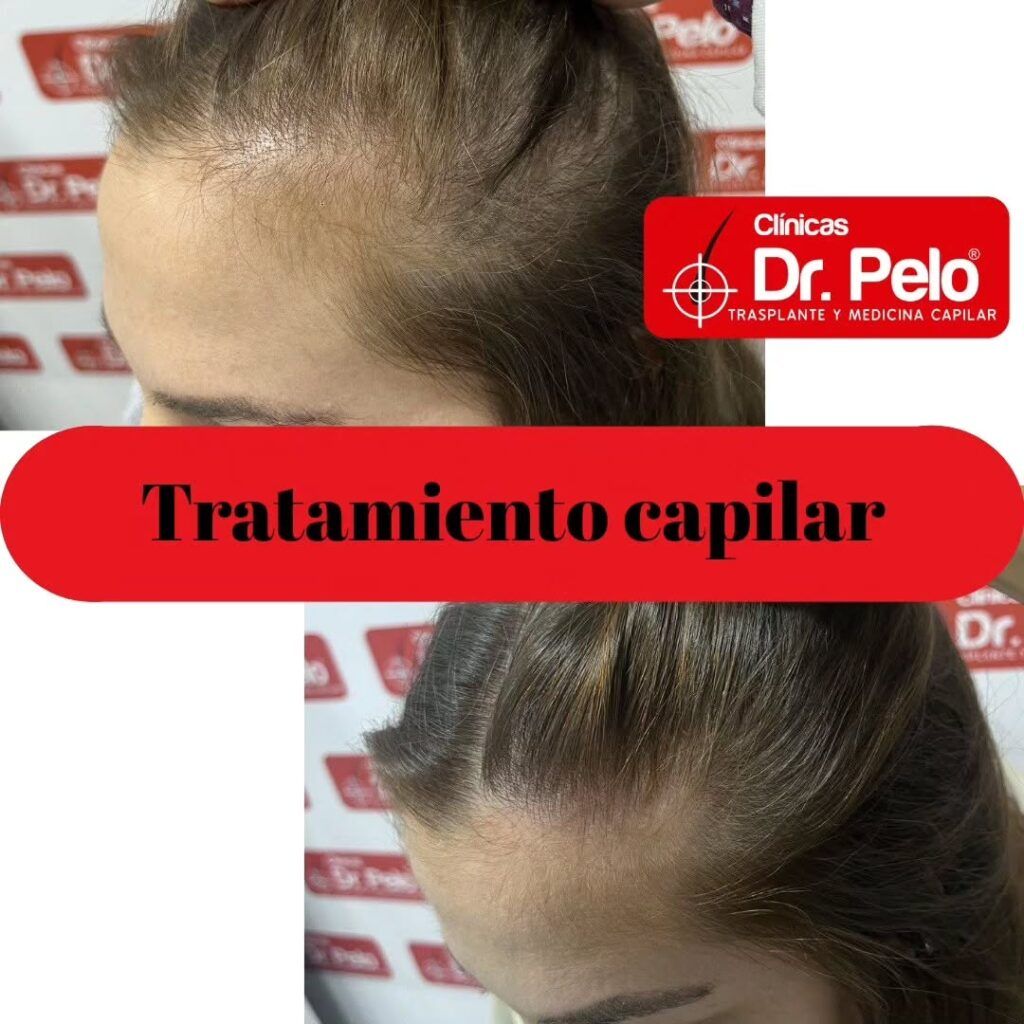 tratamiento-capilar-online-08