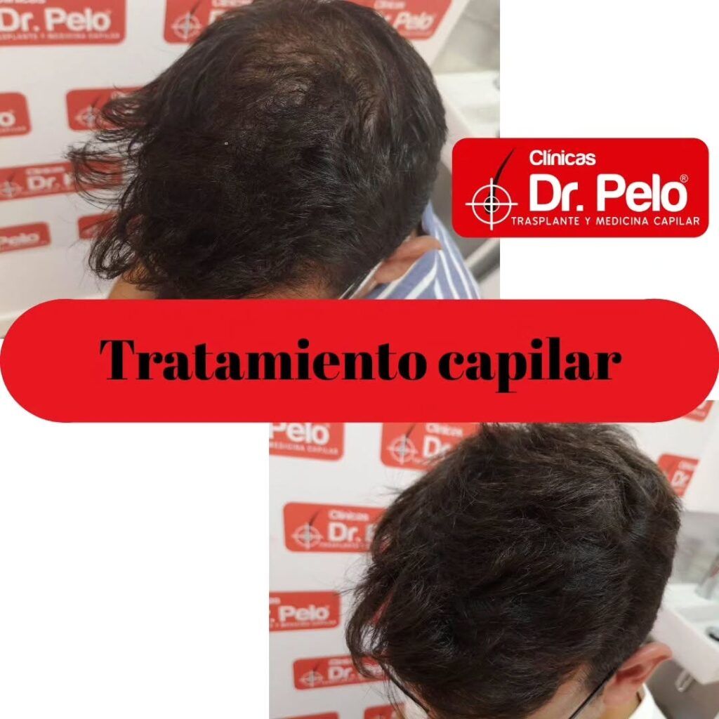 tratamiento-capilar-online-09