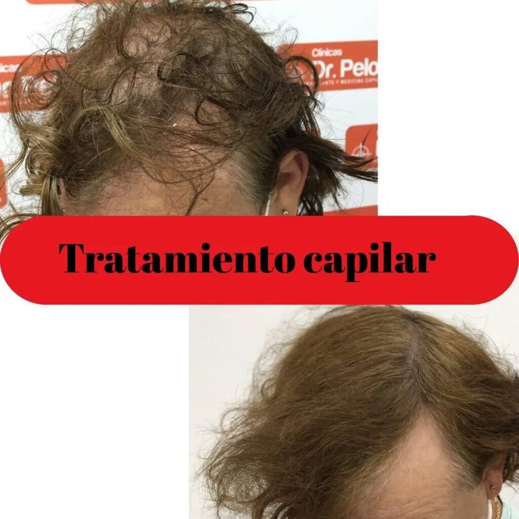 tratamiento-capilar-online-12