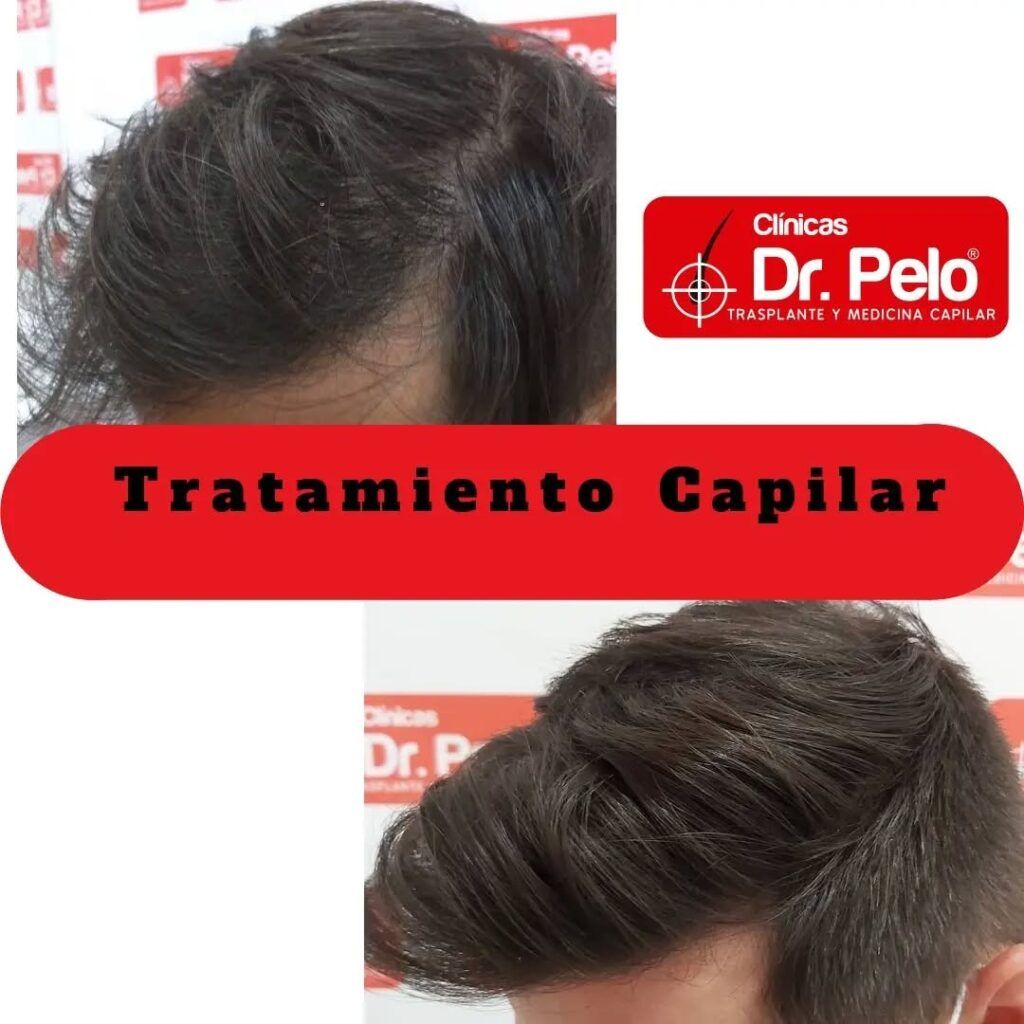 tratamiento-capilar-online-16