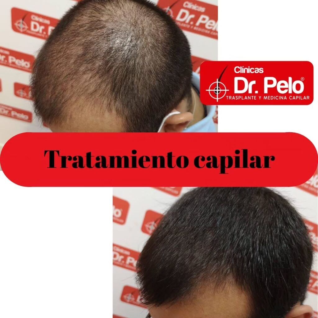 tratamiento-capilar-online-17