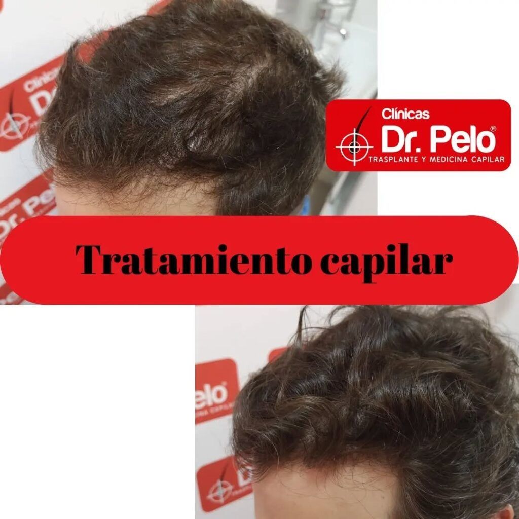 tratamiento-capilar-online-18