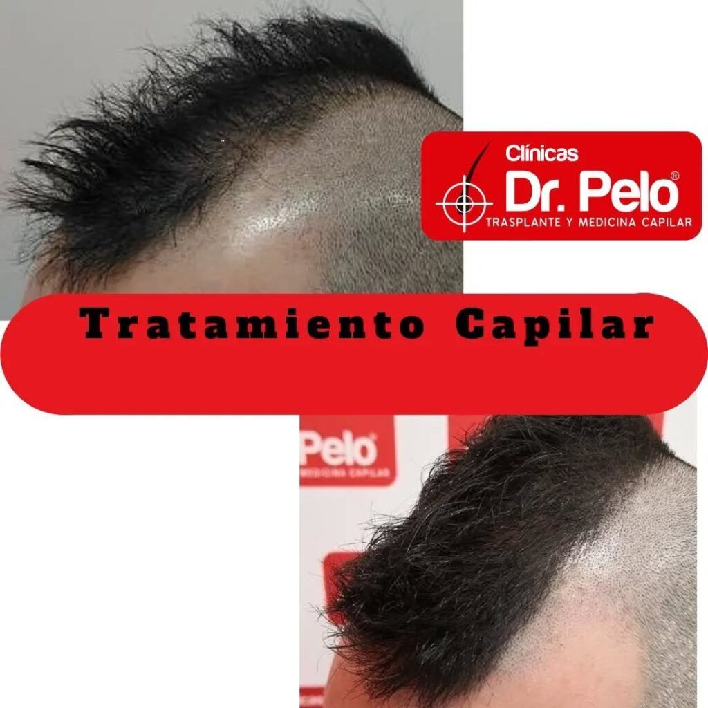 tratamiento-capilar-online-21