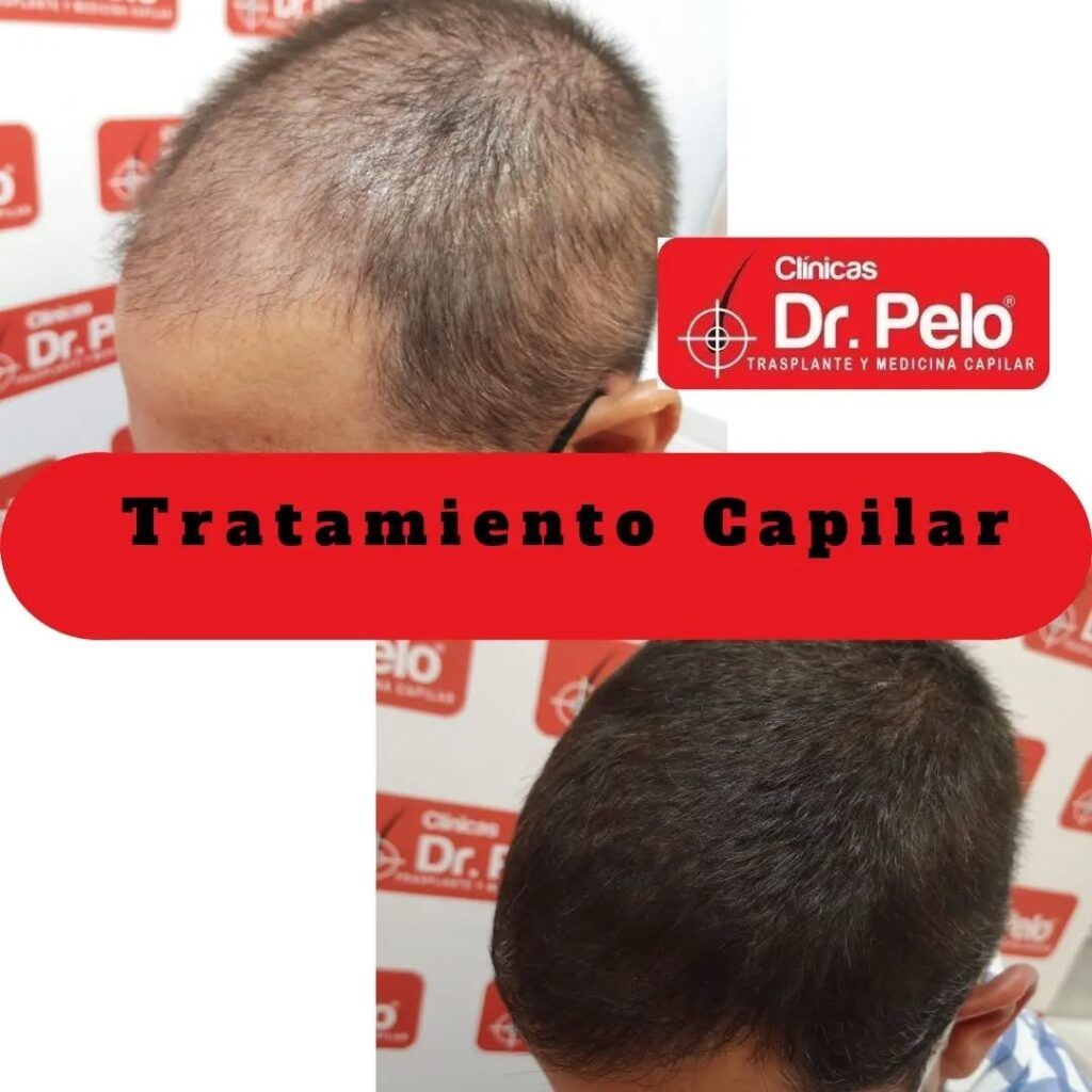 tratamiento-capilar-online-23