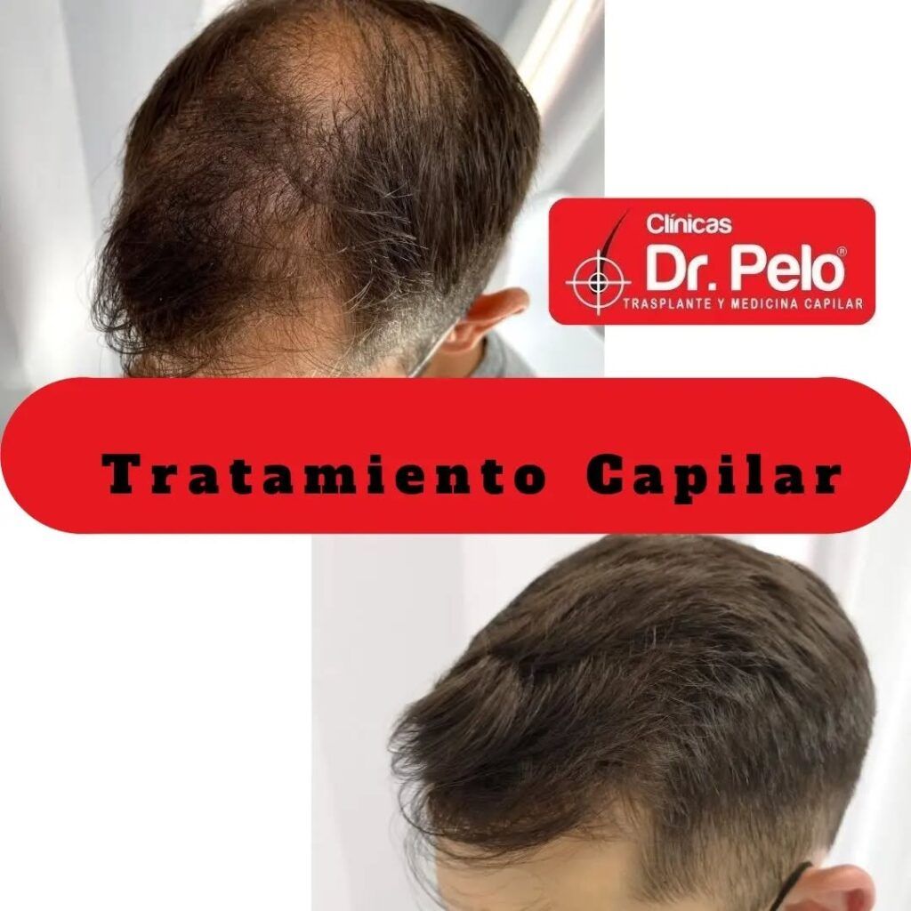 tratamiento-capilar-online-25