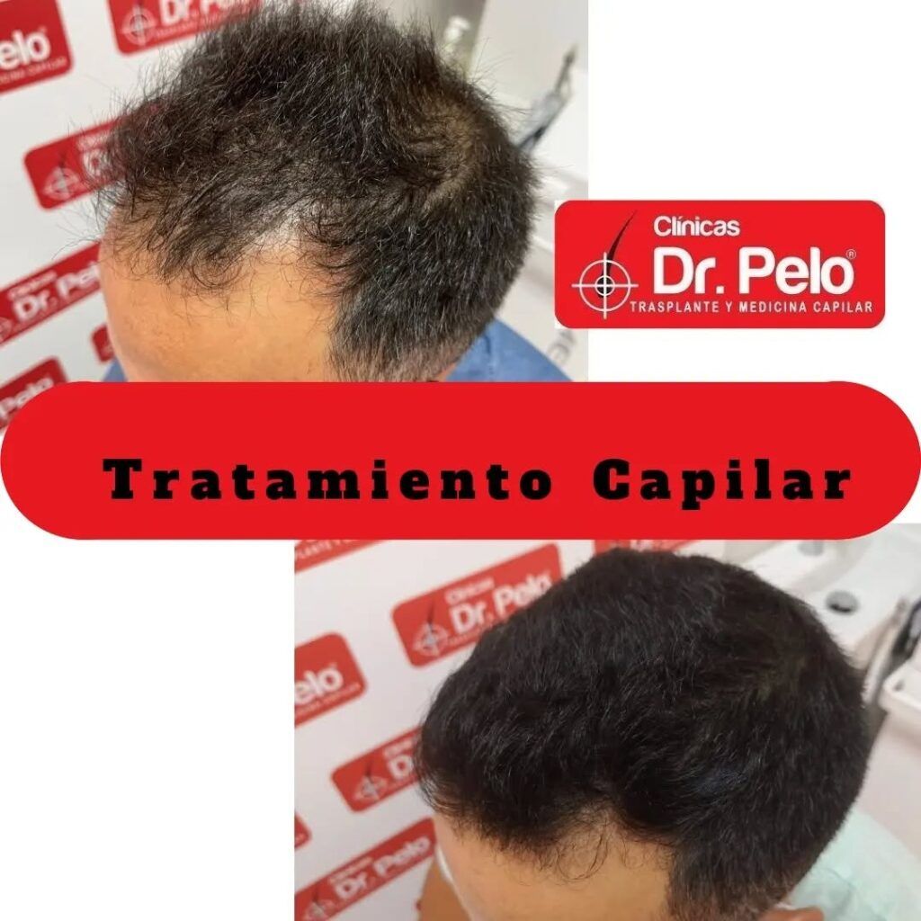 tratamiento-capilar-online-27