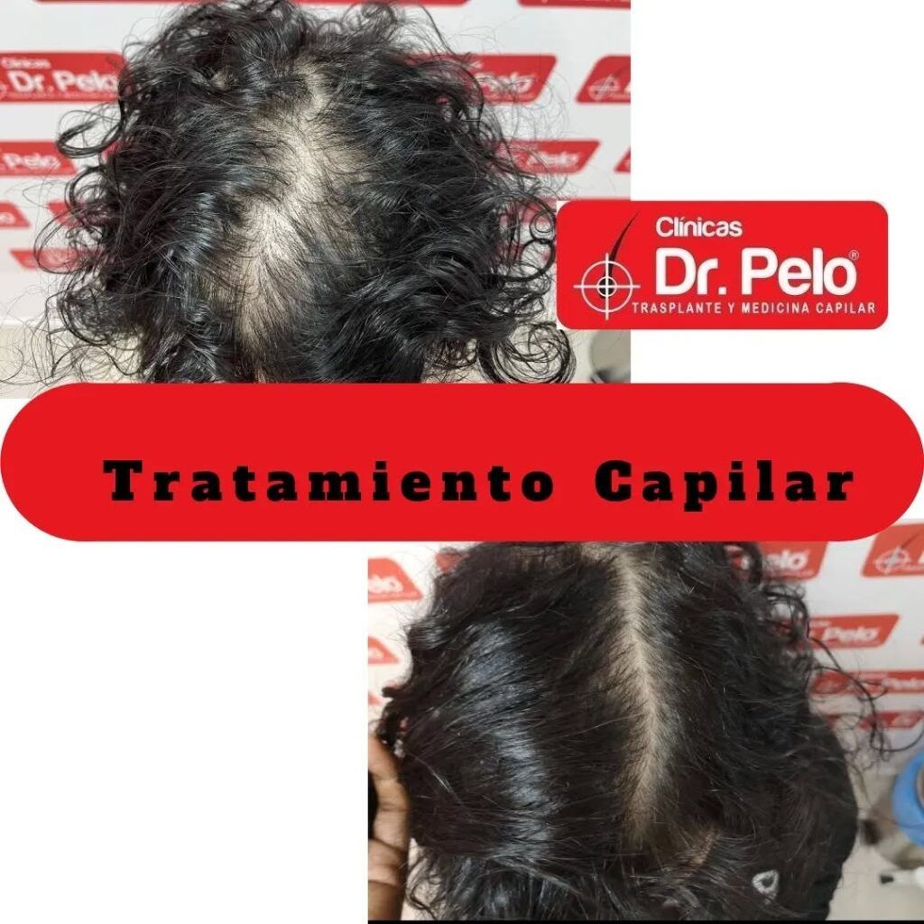 tratamiento-capilar-online-28