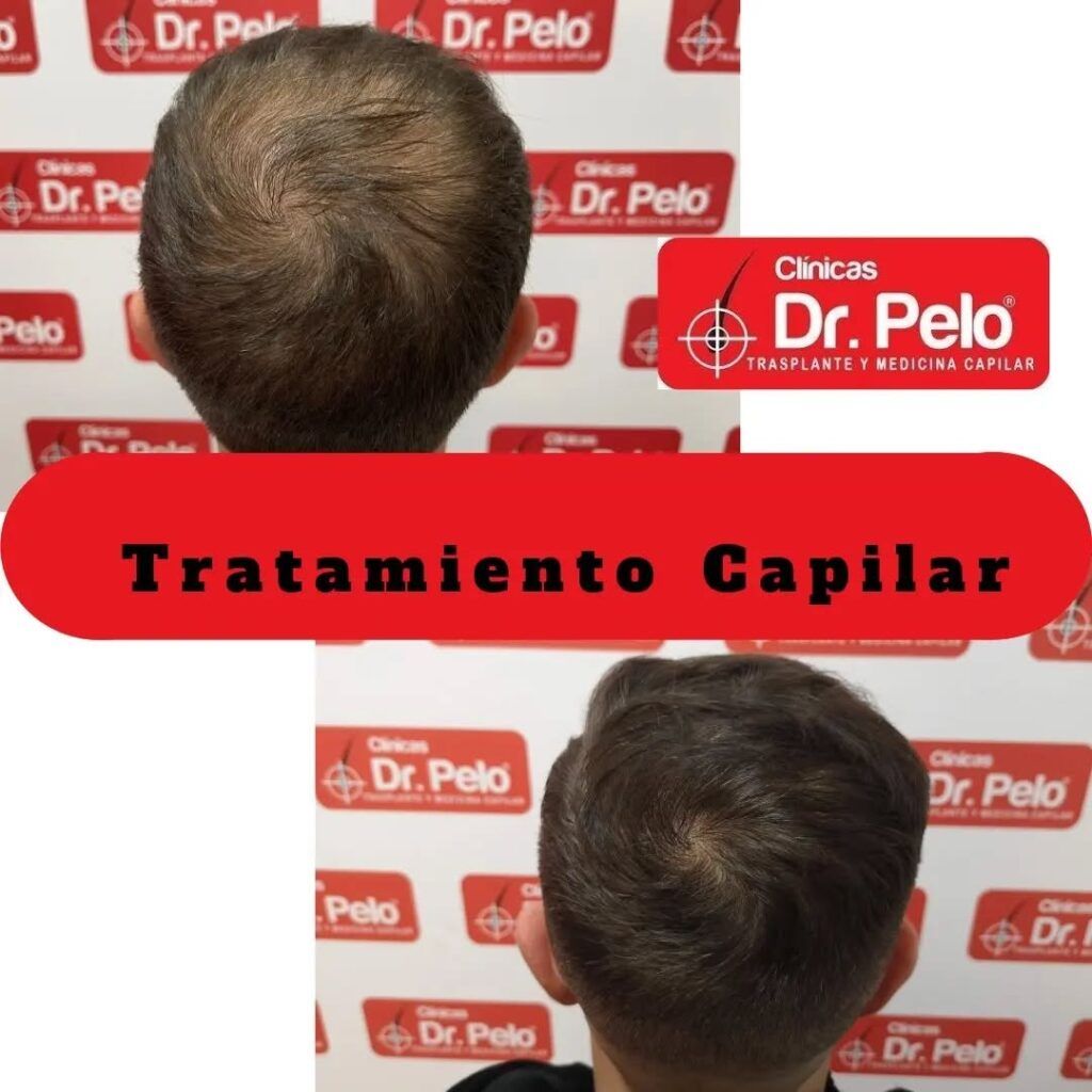 tratamiento-capilar-online-30